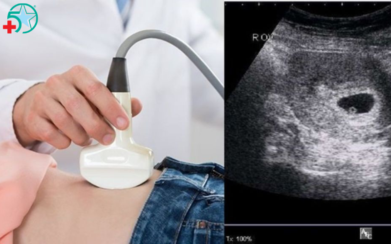 cac-moc-sieu-am-thai-nhi (2)