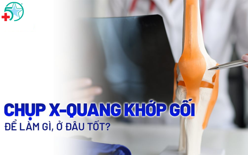 chup-x-quang-khop-goi-nghieng
