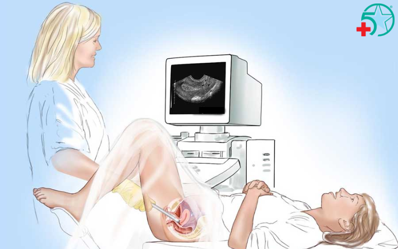 sieu-am-dau-do-co-dau-khong (1)