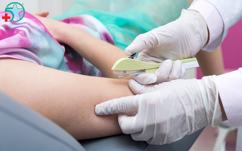 cay-que-tranh-thai-co-tac-dung-phu-khong