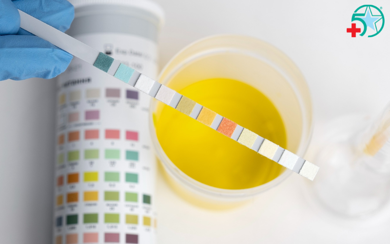 xet-nghiem-nuoc-tieu-ra-benh-gi