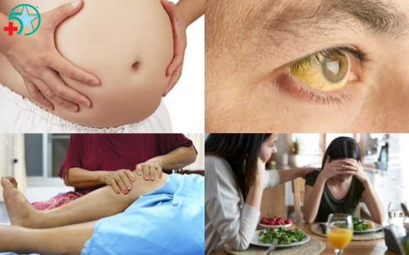 cach-dieu-tri-gan-nhiem-mo (1)