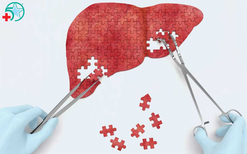 cach-dieu-tri-gan-nhiem-mo (3)