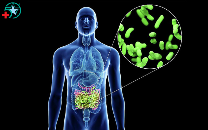 nhiem-trung-duong-ruot-la-gi