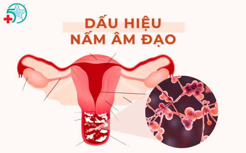 dau-hieu-bi-nam-am-dao