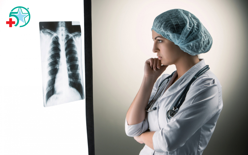 chup-x-quang-tim-phoi