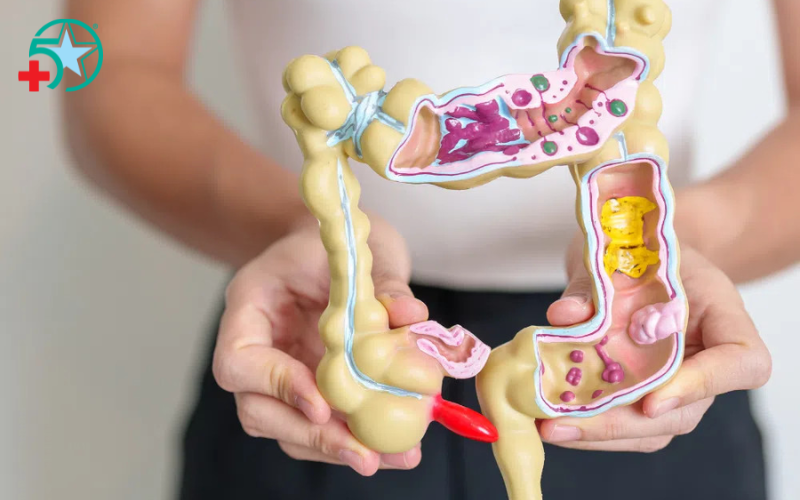 nguyen-nhan-gay-viem-ruot-thua (1)