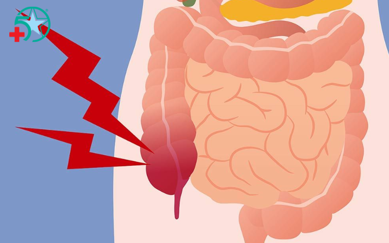 nguyen-nhan-gay-viem-ruot-thua (2)