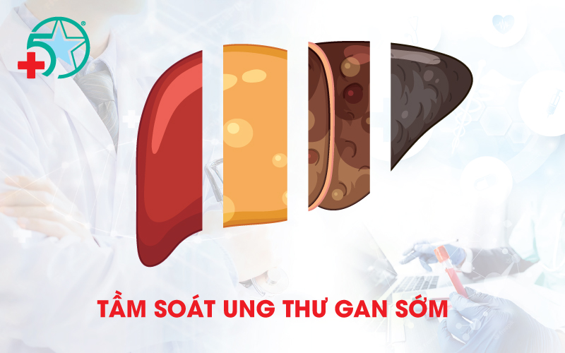 tam-soat-ung-thu-gan-som