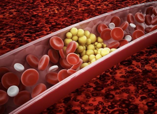 cach-giam-mo-mau-tu-nhien