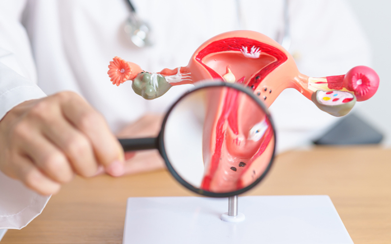 ung-thu-co-tu-cung-co-quan-he-duoc-khong