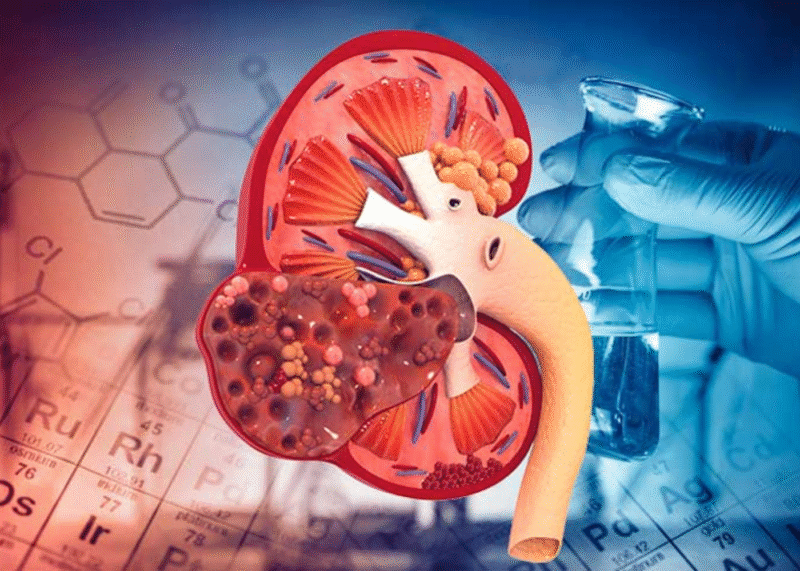 suy-than-man-la-gi-suy-than-man-co-nguy-hiem?