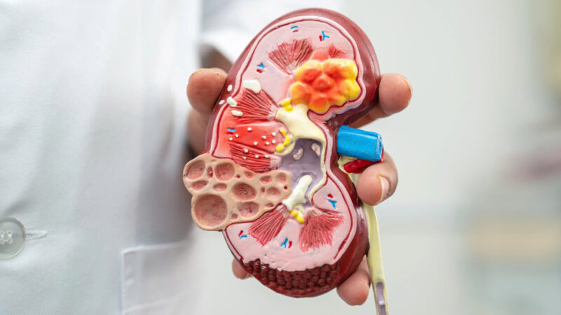 suy-than-man-la-gi-suy-than-man-co-nguy-hiem?