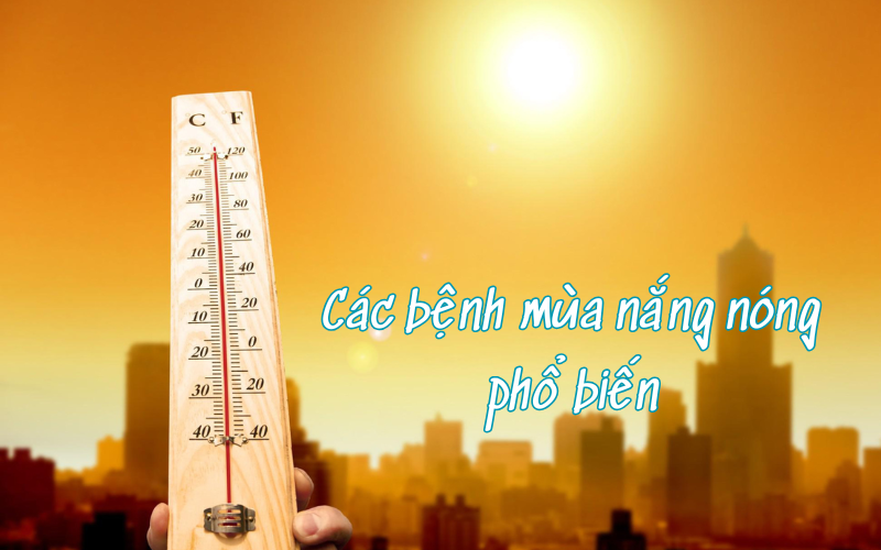 10-benh-mua-nang-nong-o-tre-nho-va-nguoi-lon