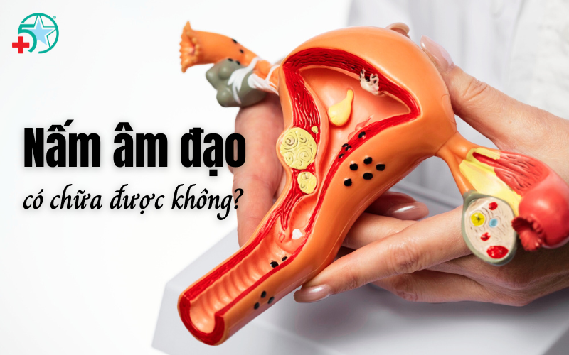 nam-am-dao-la-gi-nam-am-dao-co-chua-duoc-khong?