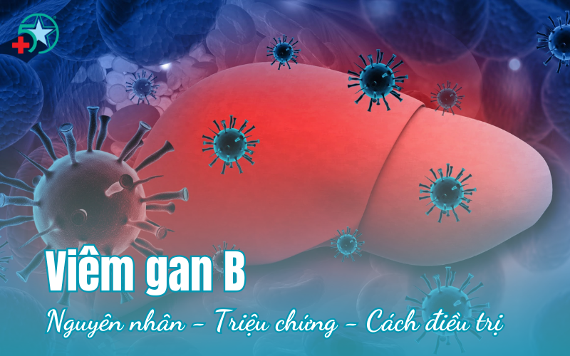 viem-gan-b-nguyen-nhan-trieu-chung-cach-dieu-tri