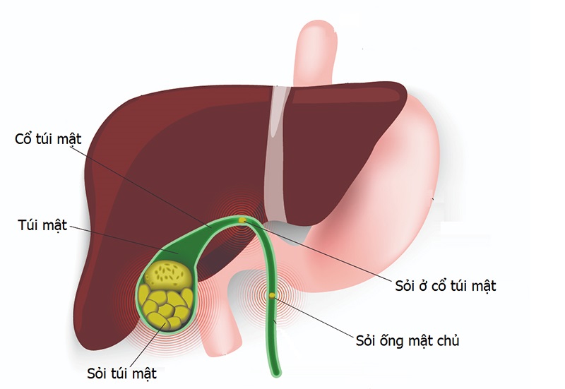 soi-tui-mat-am-tham-nhung-nguy-hiem-hieu-dung...