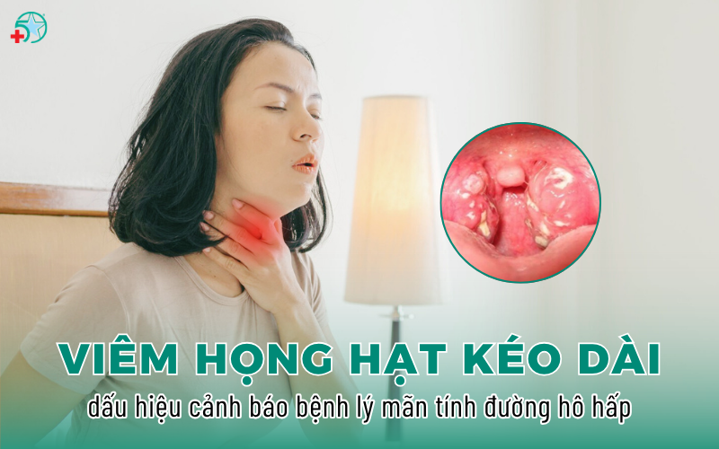 viem-hong-hat-keo-dai-dau-hieu-canh-bao-benh-ly..