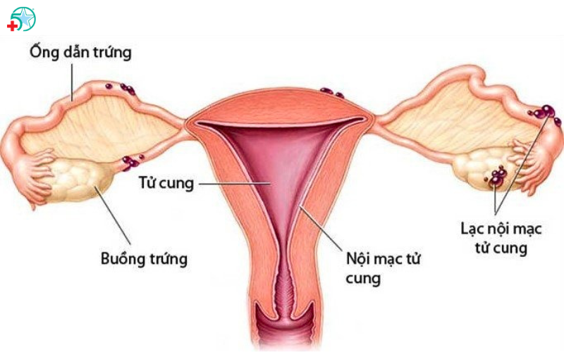 u-nang-buong-trung-co-nguy-hiem-khong-khi-nao-can