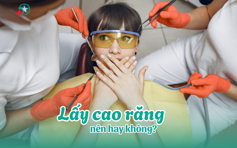 lay-cao-rang-co-nen-dinh-ky-de-bao-ve-suc-khoe