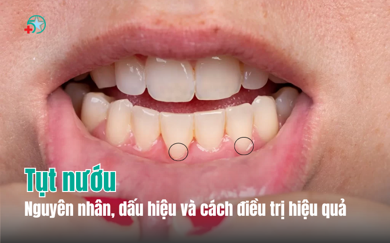 tut-nuou-nguyen-nhan-dau-hieu-va-cach-dieu-tri