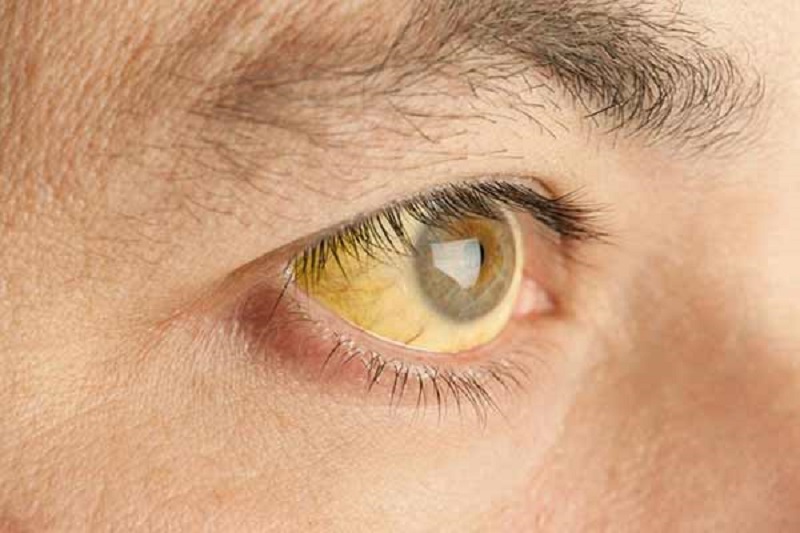 soi-tui-mat-am-tham-nhung-nguy-hiem-hieu-dung...