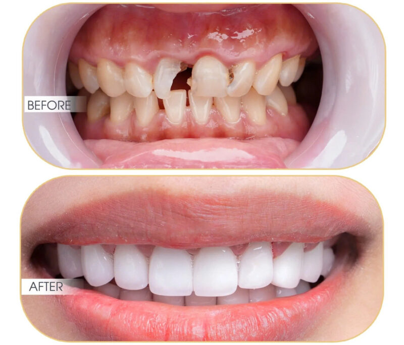 tong-hop-cac-goi-kham-nha-khoa-khuyen-mai