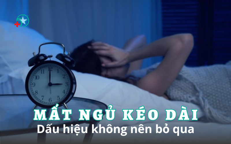 mat-ngu-keo-dai-dau-hieu-khong-nen-bo-qua