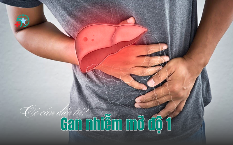 gan-nhiem-mo-cap-do-1-co-can-dieu-tri-khong?
