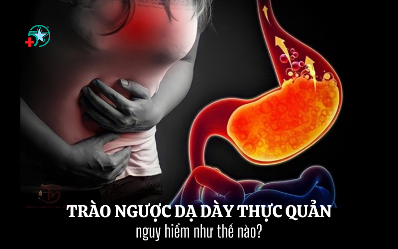 trao-nguoc-da-day-thuc-quan-benh-ly-pho-bien-de..