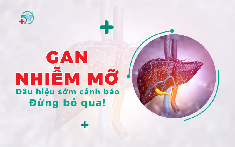 gan-nhiem-mo-la-gi-dau-hieu-canh-bao-va-phuong...