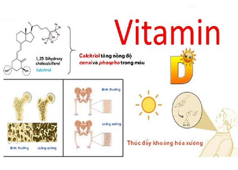 thieu-vitamin-d-nguyen-nhan-gay-loang-xuong...