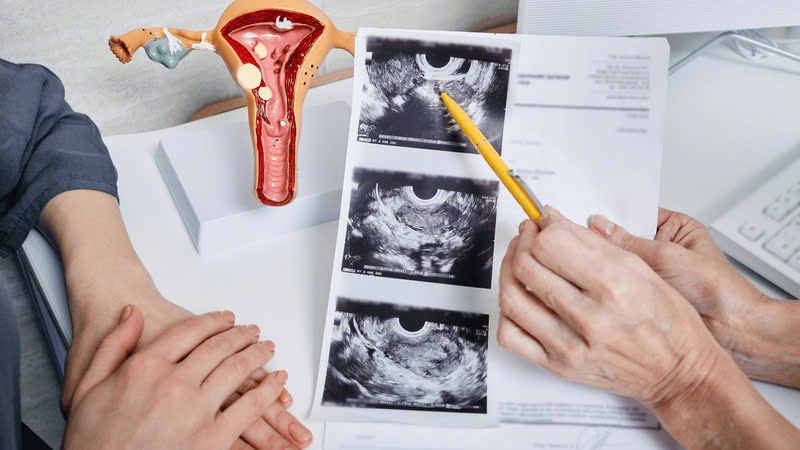 kinh-nguyet-khong-deu-co-phai-dau-hieu-buong-...