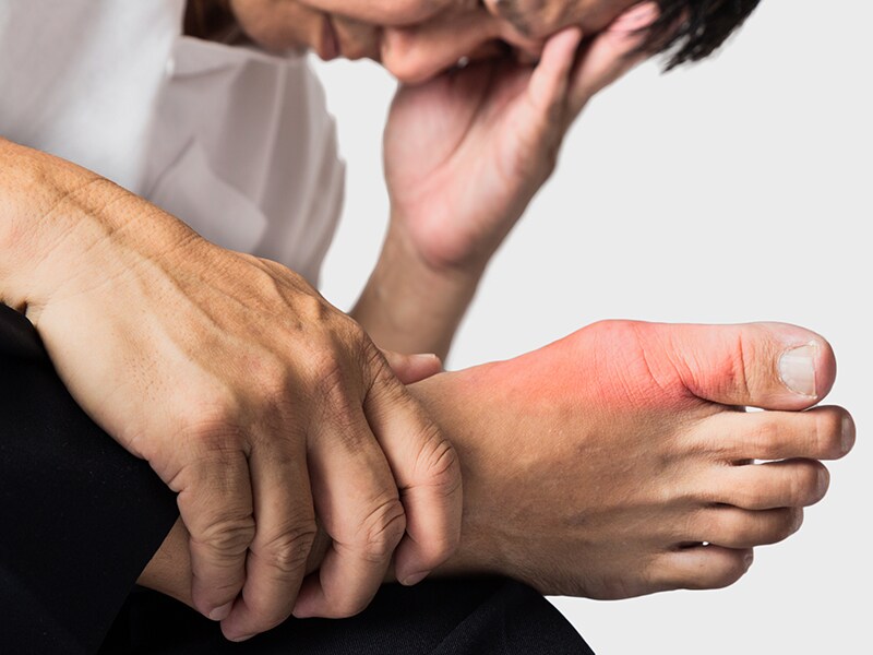 benh-gout-cap-tim-hieu-toan-dien-va-cach-xu-tri