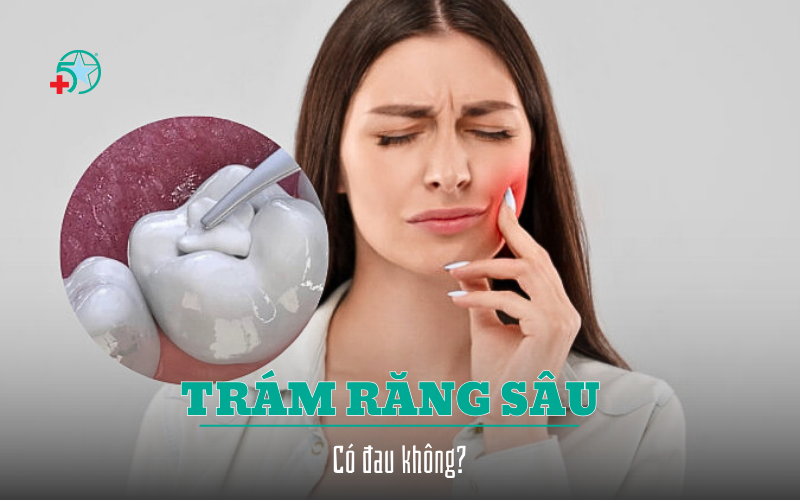 tram-rang-sau-co-dau-khong-quy-trinh-tram-rang...