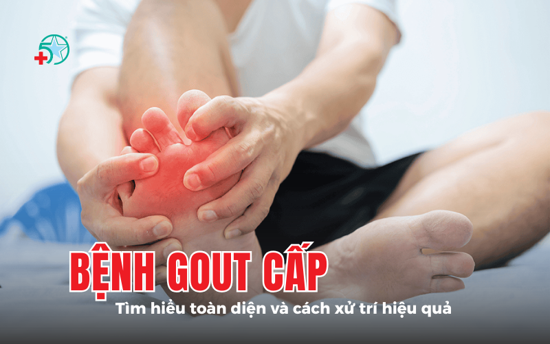 benh-gout-cap-tim-hieu-toan-dien-va-cach-xu-tri