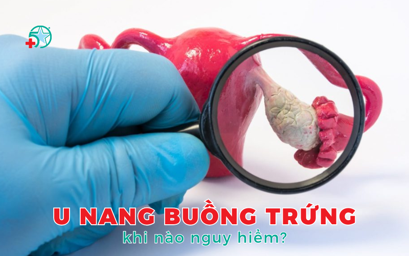 u-nang-buong-trung-su-that-phia-sau-noi-lo-lang..