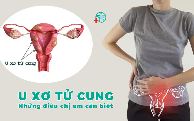 u-xo-tu-cung-su-that-noi-lo-va-cach-chi-em-tu-bao