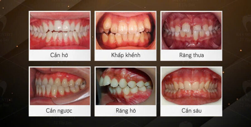 không-có-tiền-trong-tiền-với-loại-bac-si-đó..