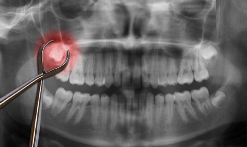 nho-rang-khon-noi-am-anh-hay-chi-la-hieu-lam