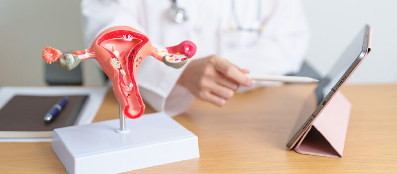 u-xo-tu-cung-su-that-noi-lo-va-cach-chi-em-tu-bao