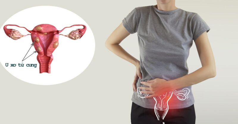 u-xo-tu-cung-su-that-noi-lo-va-cach-chi-em-tu-bao