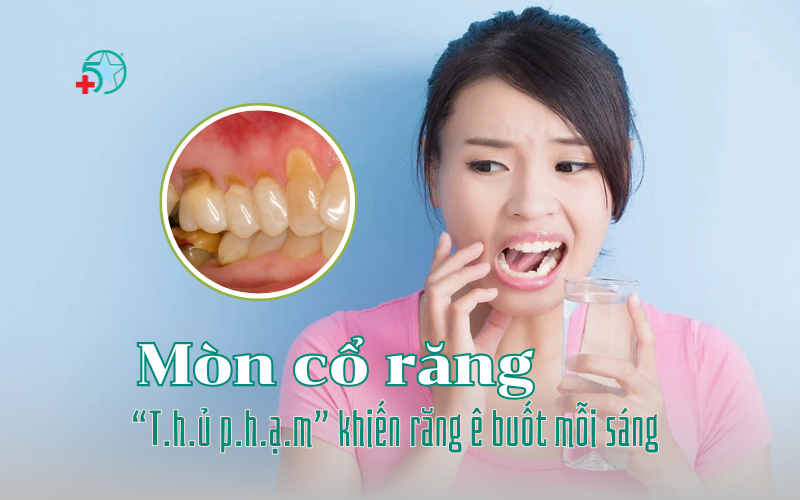 mon-co-rang-nguyen-nhan-dau-hieu-va-cach-dieu-tri