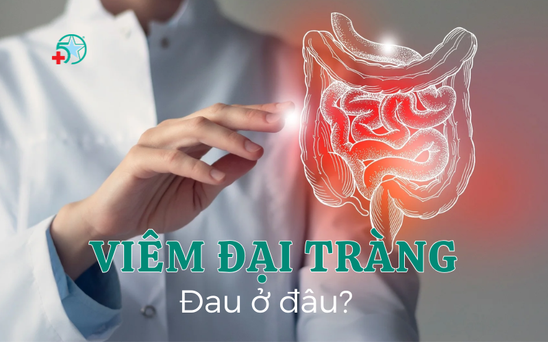 viem-dai-trang-dau-o-dau-su-nguy-hiem-cua-benh...