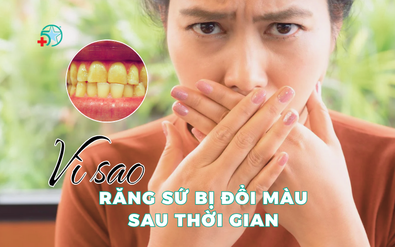 rang-su-bi-doi-mau-sau-thoi-gian-nguyen-nhan-va..