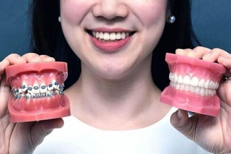 nieng-rang-loai-nao-tot-nhat-hien-nay-huong-dan..