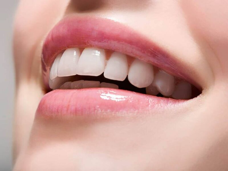 rang-ho-nhe-co-can-nieng-khong-hay-chi-can-boc-su