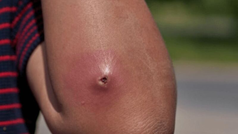 dung-tu-y-nan-mun-hoac-ap-xe-tai-nha-canh-bao