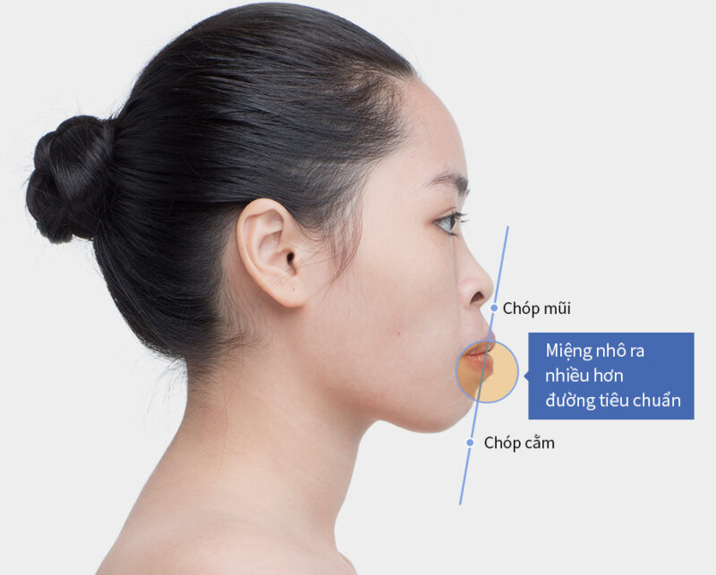 rang-ho-nhe-co-can-nieng-khong-hay-chi-can-boc-su