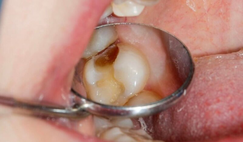 khong-dau-rang-kham-nha-khoa-dinh-ky-co-thuc-su..